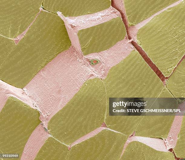 skeletal muscle fibres, sem - sem stock pictures, royalty-free photos & images