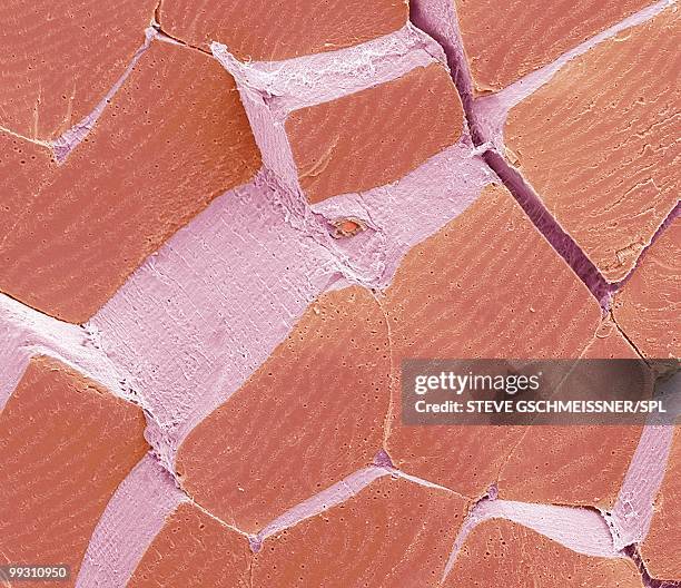 skeletal muscle fibres, sem - skelettmuskel stock-fotos und bilder