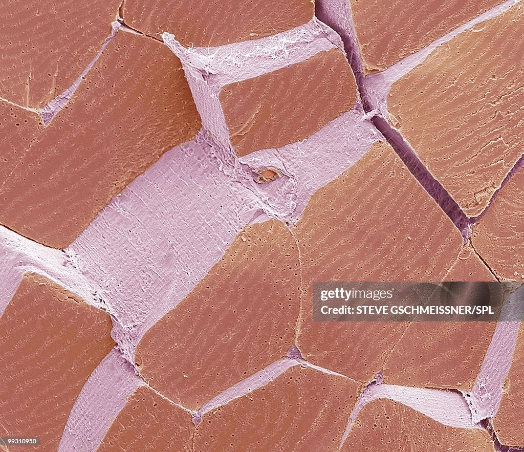 Skeletal muscle fibres, SEM