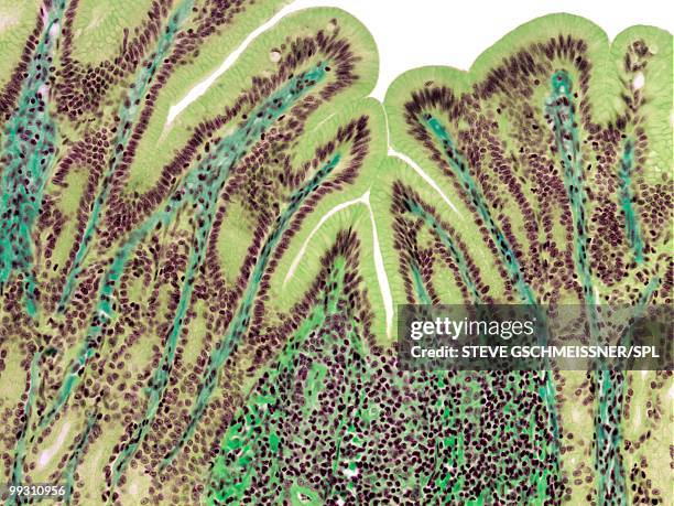 stomach lining, light micrograph - organinneres stock-fotos und bilder