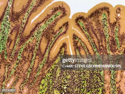 Stomach lining, light micrograph Stomach lining, light micrograph