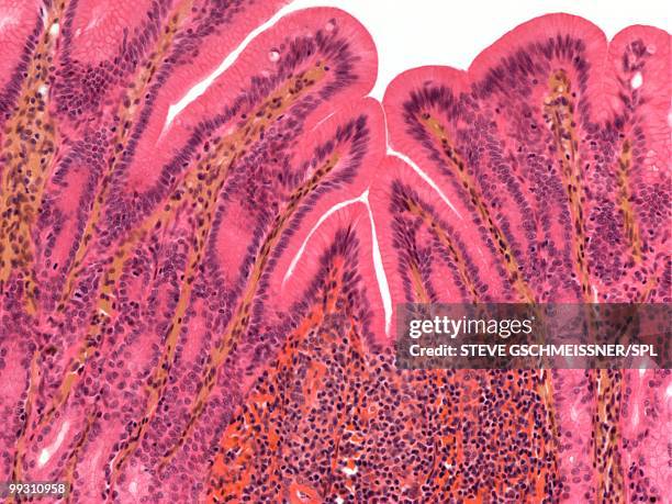 stomach lining, light micrograph - lúmen imagens e fotografias de stock