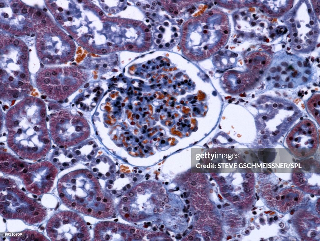 Kidney glomerulus, light micrograph