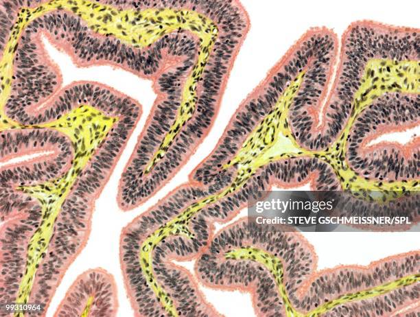 fallopian tube, light micrograph - lumen stock pictures, royalty-free photos & images