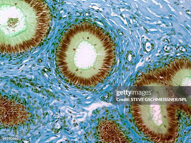 epididymis, light micrograph - escroto fotografías e imágenes de stock