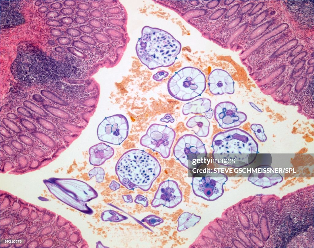 Nematode infection, light micrograph
