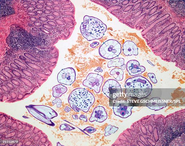 nematode infection, light micrograph - animal abdomen stock pictures, royalty-free photos & images