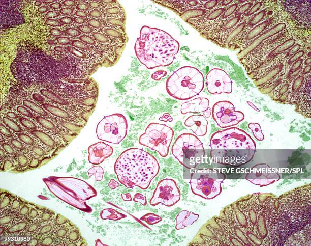 nematode infection, light micrograph - animal abdomen stock pictures, royalty-free photos & images