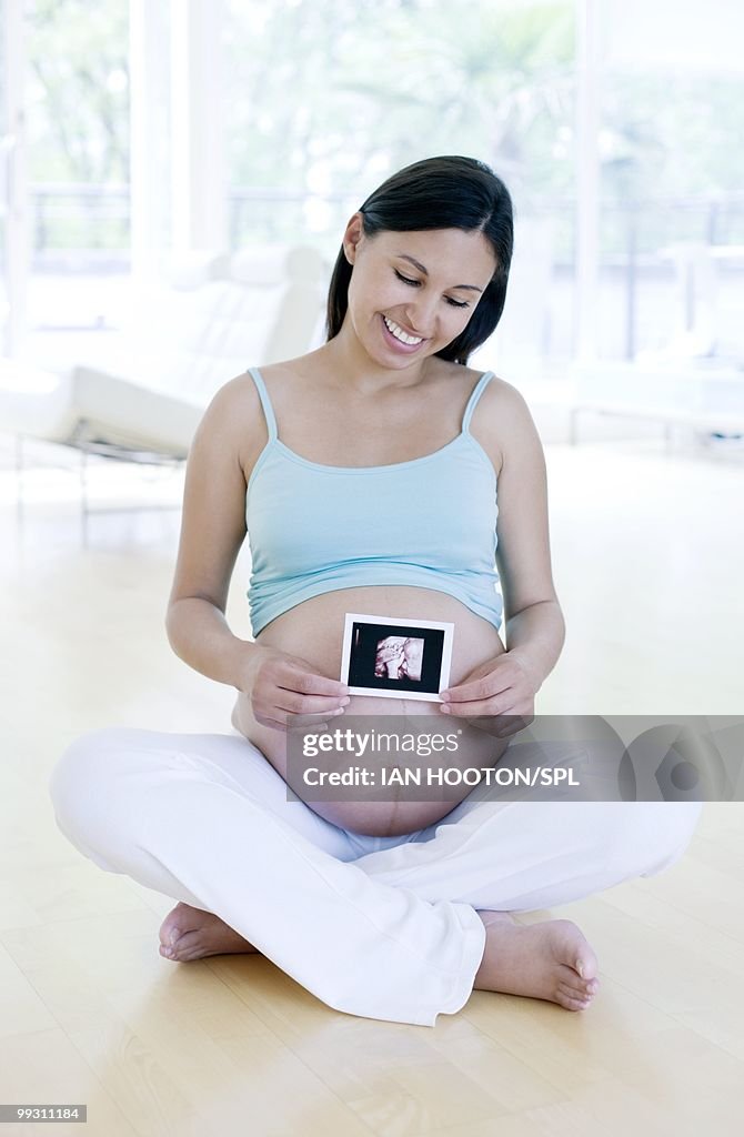 Pregnant woman holding her baby scan