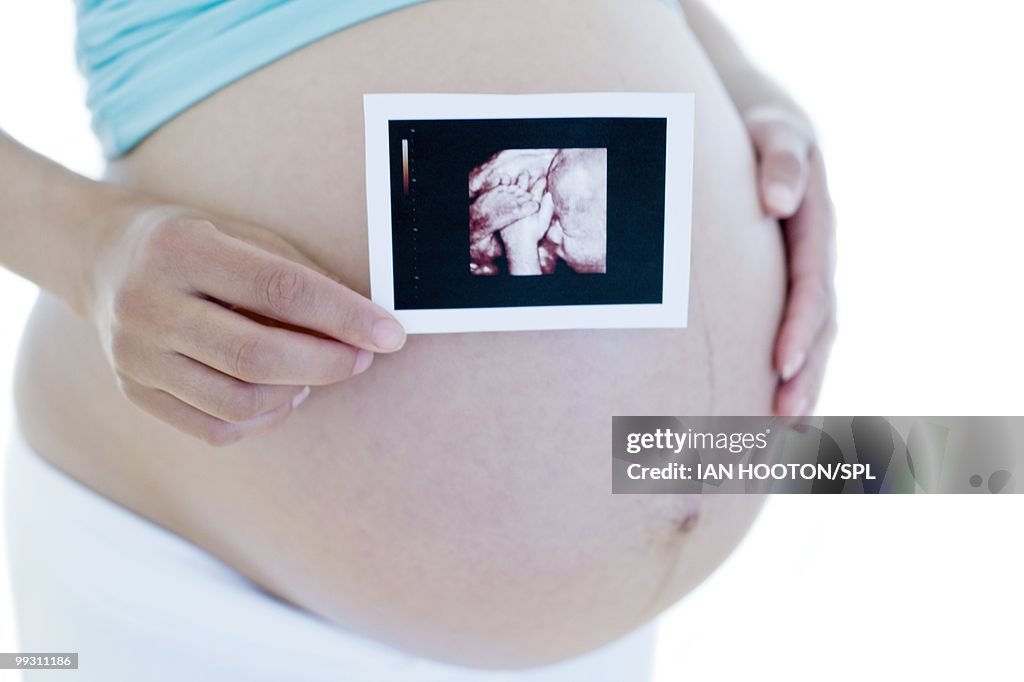 Pregnant woman holding her baby scan