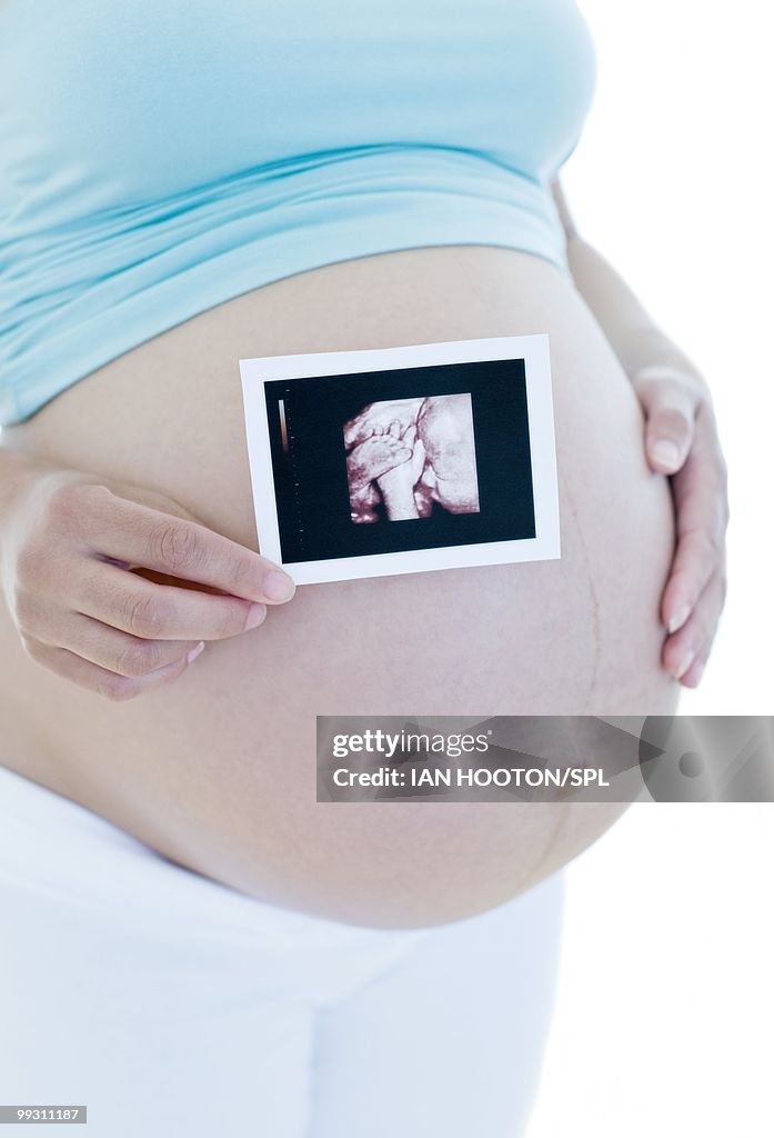 Pregnant woman holding her baby scan