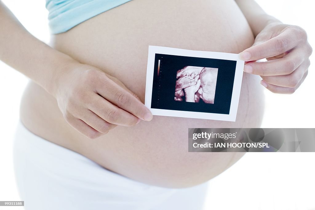 Pregnant woman holding her baby scan