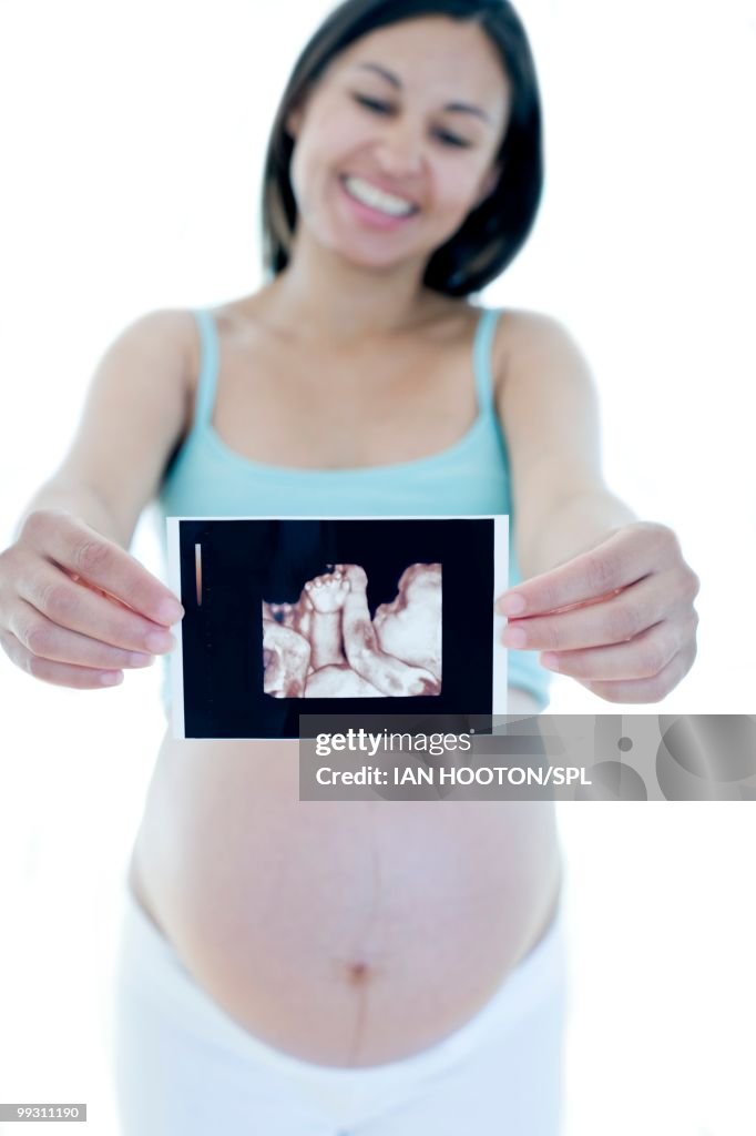 Pregnant woman holding her baby scan
