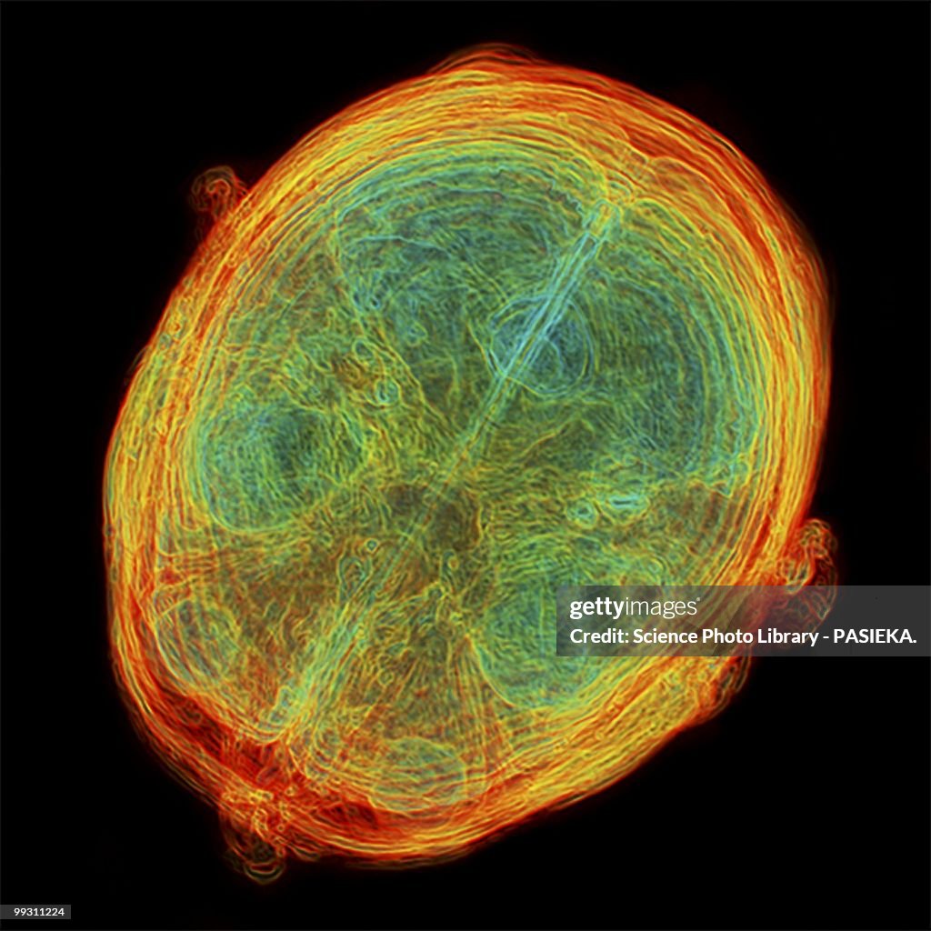 Inside Brain Real Human Brain 3dmri Scan High-Res Vector Graphic - Getty Images