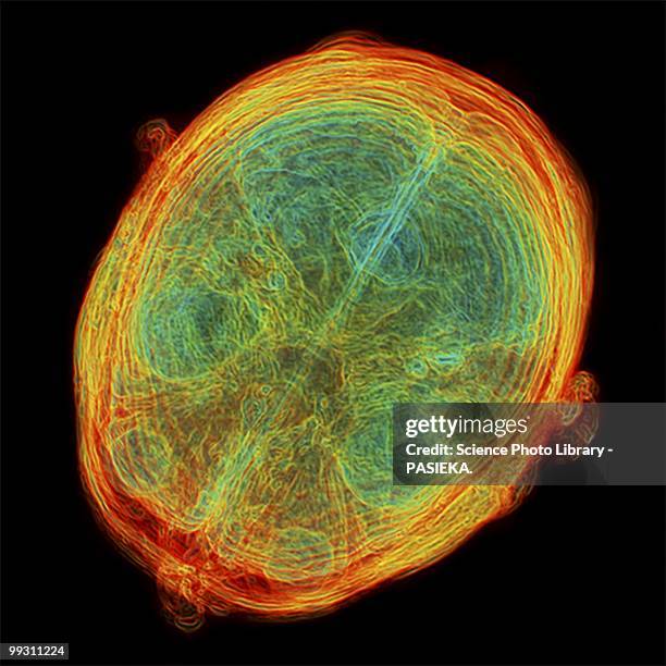 Scan Heae 733 Mri Scan Image High Res Illustrations - Getty Images