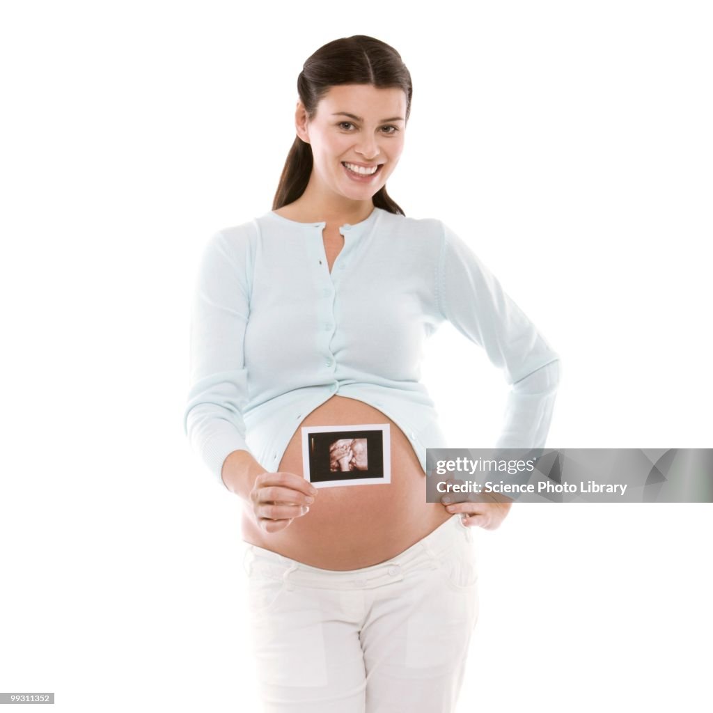Pregnant woman holding her baby scan