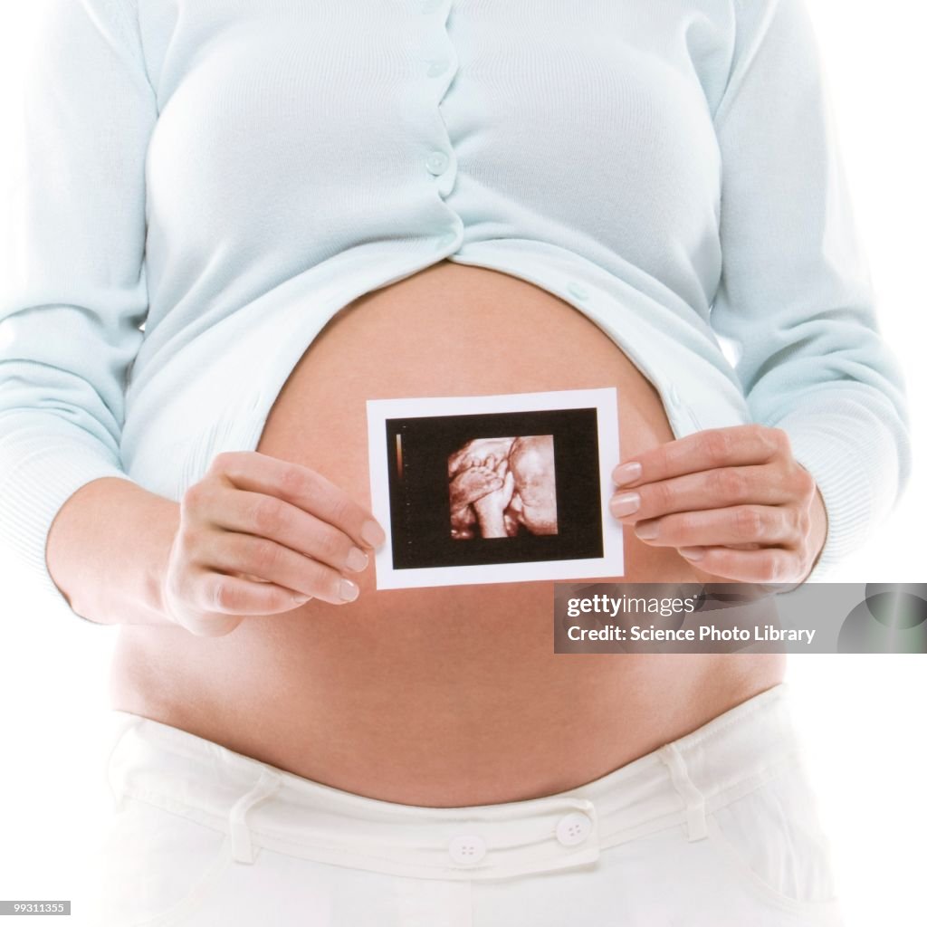 Pregnant woman holding her baby scan