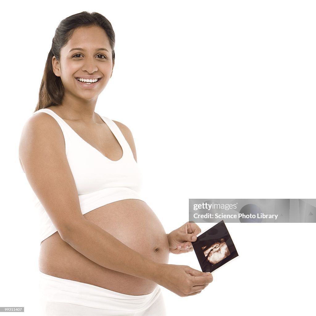 Pregnant woman holding her baby scan