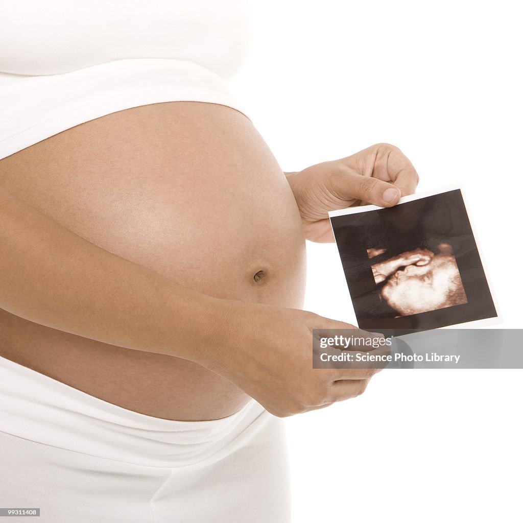 Pregnant woman holding her baby scan