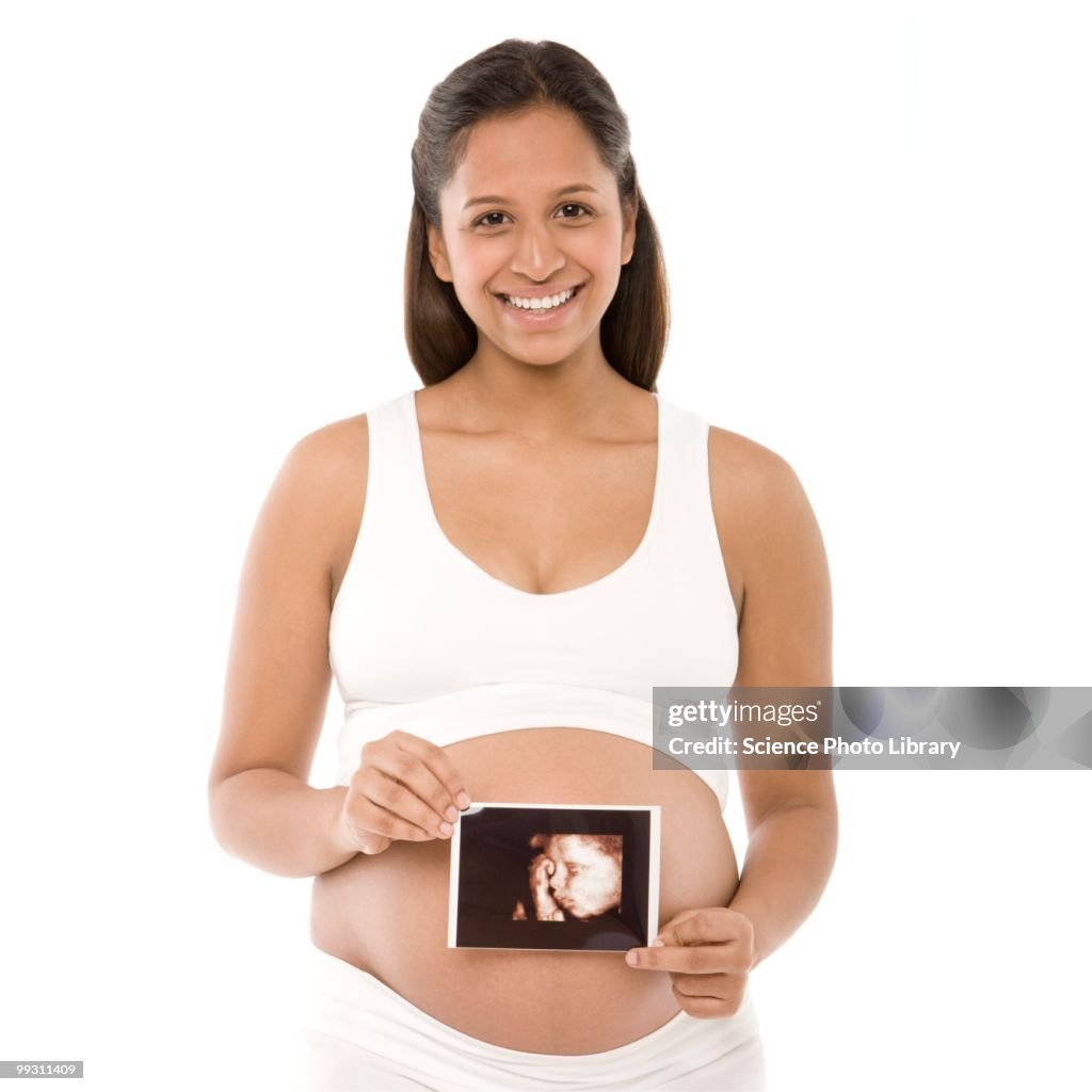 Pregnant woman holding her baby scan