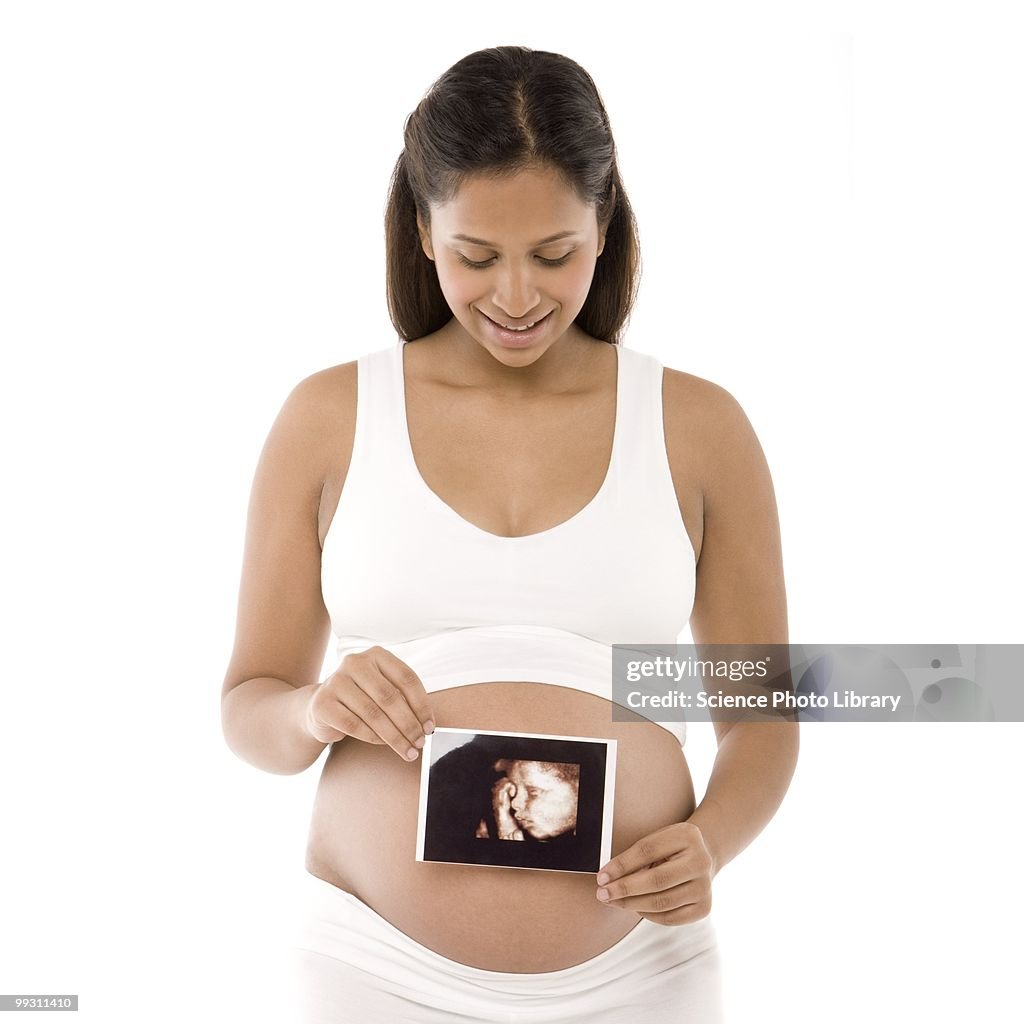 Pregnant woman holding her baby scan