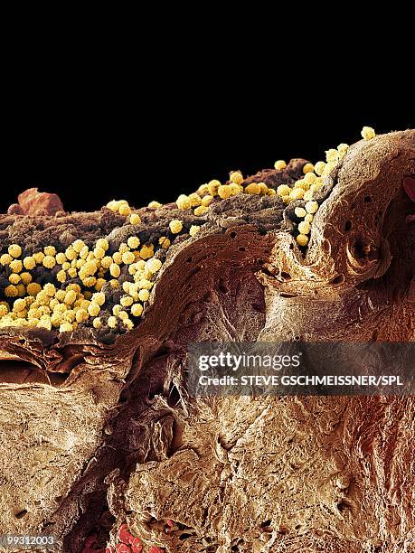 Pyoderma Microscope Slide 1,353 Steve Gschmeissner Stock Photos, High-Res Pictures, and Images ...