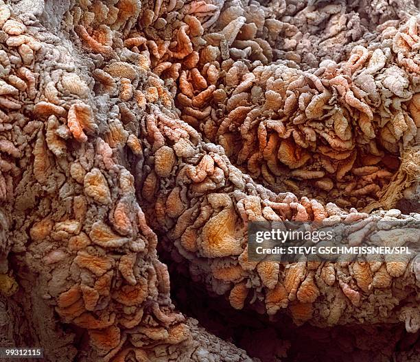 intestinal villi, sem - villus stock pictures, royalty-free photos & images