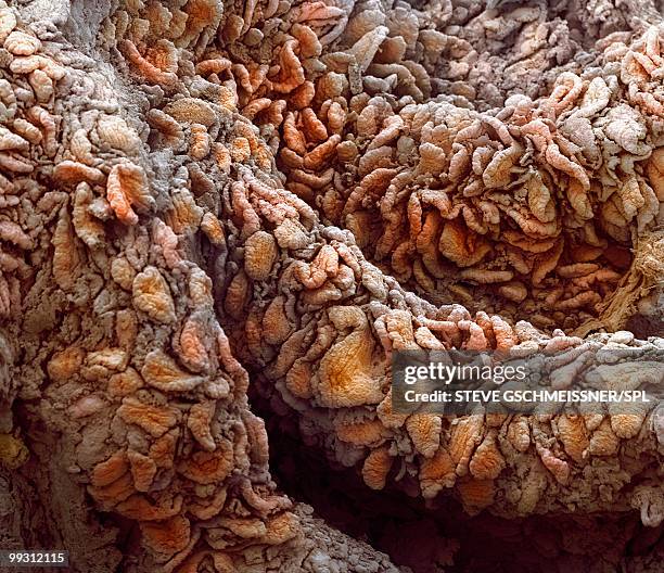 intestinal villi, sem - intestino delgado humano imagens e fotografias de stock