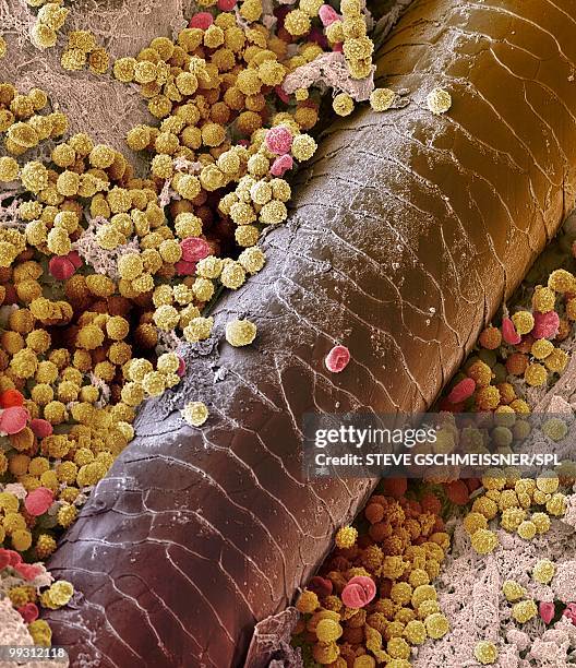 Human Skin Sem Photos and Premium High Res Pictures - Getty Images