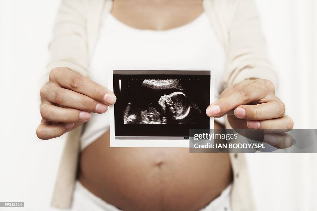 Pregnant woman holding her baby scan