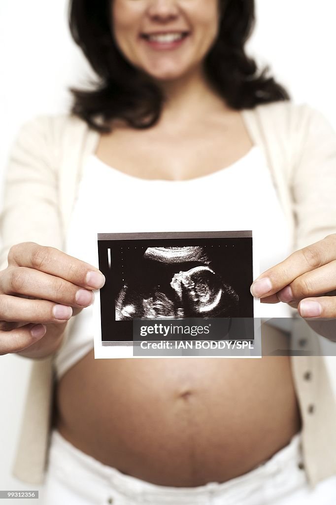 Pregnant woman holding her baby scan