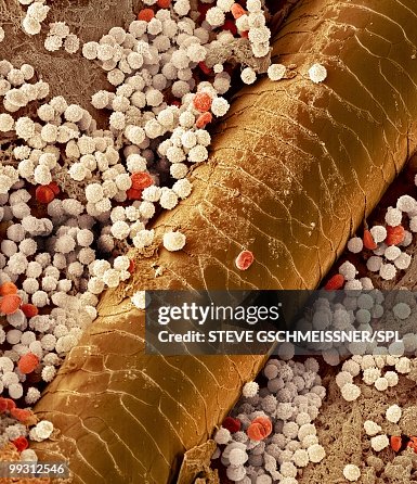 Pyoderma skin disease, SEM Pyoderma skin disease, SEM