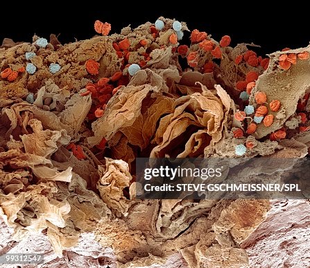 Pyoderma skin disease, SEM Pyoderma skin disease, SEM