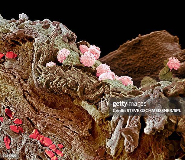 pyoderma skin disease, sem - micrografía electrónica escaneadora fotografías e imágenes de stock