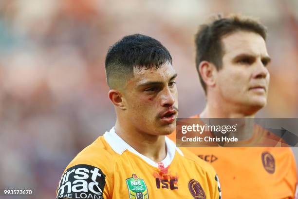 Kotoni Staggs of the Broncos leaves the field injured during the round 17 NRL match between the Gold Coast Titans and the Brisbane Broncos at Cbus...