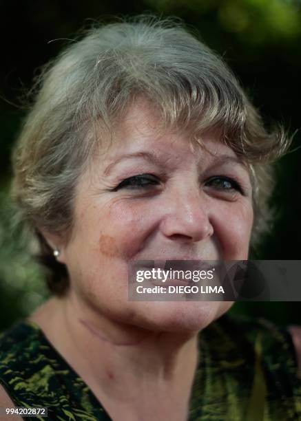 Neighbour from the soybean fields, Maria Rosa Vesina, who is in treatment and suspects her disease is caused by the agrochemicals, poses for a...