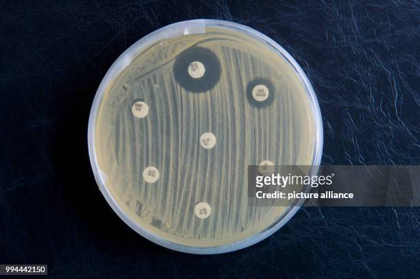 Germs can be seen in a petri dish at the Institute for Hygiene and Public Health in Hamburg, Germany, 19 September 2017. The white platelets pass on...