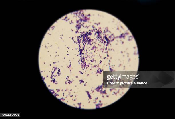Germs can be seen through the lense of a microscope with 1000x magnification at the Institute for Hygiene and Public Health in Hamburg, Germany, 19...