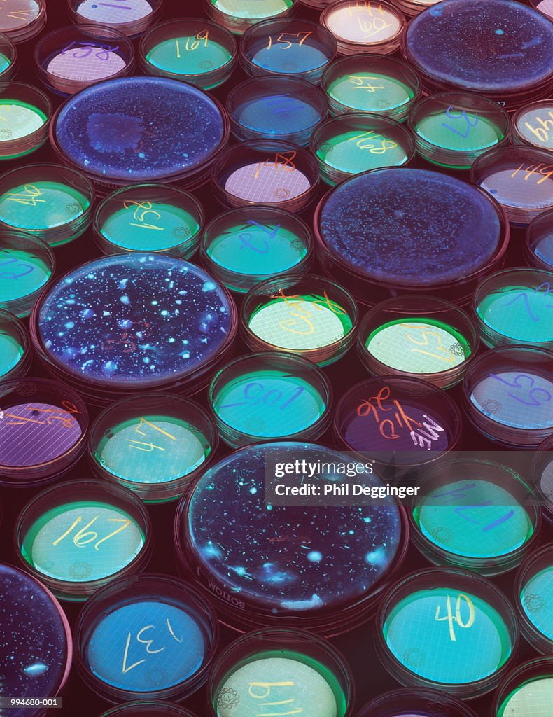 Coliform bacterial cultures in petri dishes