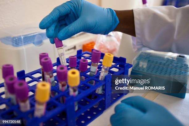 clinical trial site, ndlela, mpumalanga, south africa - aids stock pictures, royalty-free photos & images