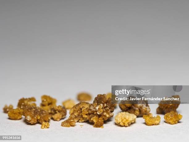 784 Kidney Stone Stock Photos, High-Res Pictures, and Images - Getty Images