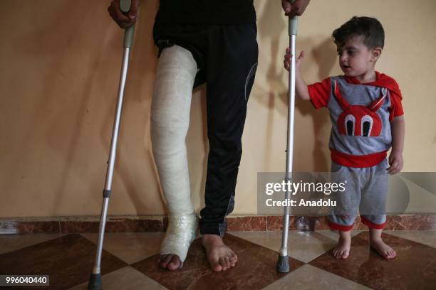 Palestinian Izzeddin Sahin who shot and wounded by Israeli forces during the protest within the "Great March of Return" demonstrations, is seen with...