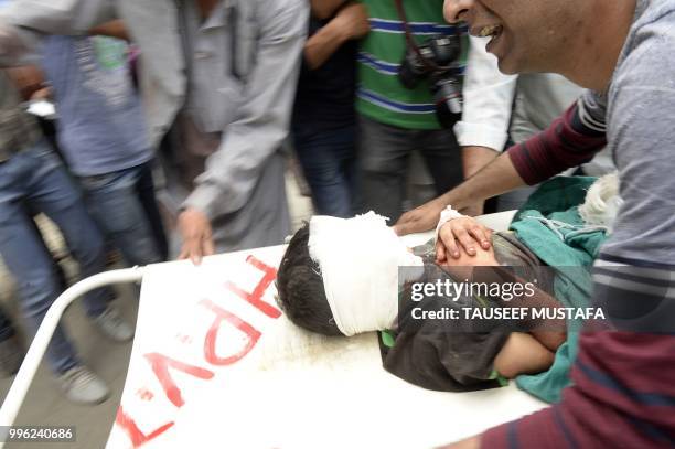 An injured Kashmiri boy is carried on a stretcher at a hospital in Srinagar on July 11 where they were brought after being wounded in a blast after a...