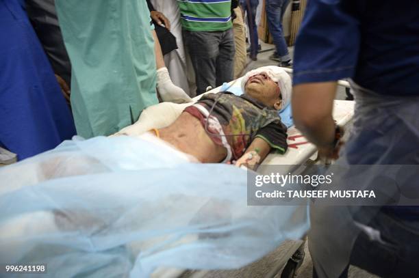 An injured Kashmiri boy is carried on a stretcher at a hospital in Srinagar on July 11 where they were brought after being wounded in a blast after a...