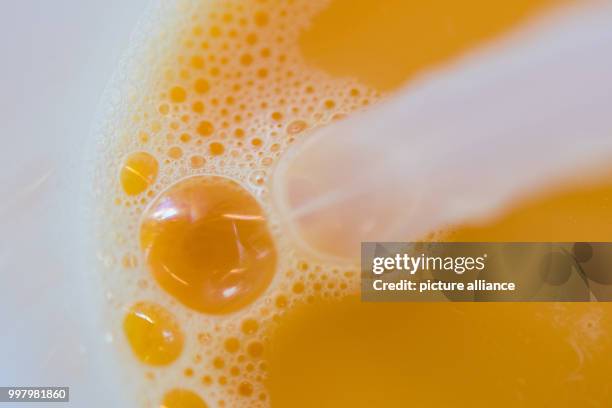 Egg is being extracted with a pipette in a laboratory of the Chemical and Veterinary Investigation Office in Krefeld, Germany, 7 August 2017. The...