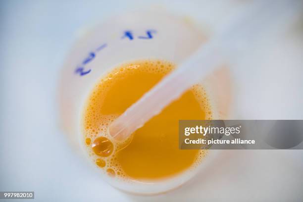 Egg is being extracted with a pipette in a laboratory of the Chemical and Veterinary Investigation Office in Krefeld, Germany, 7 August 2017. The...