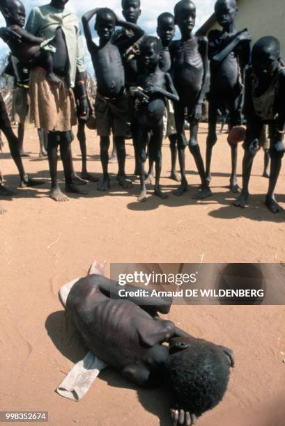 Enfant ougandais mort de faim en août 1980 en Ouganda.