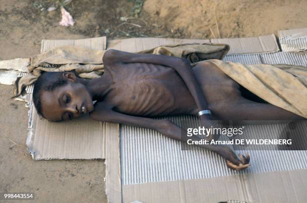 Enfant souffrant de malnutrition en mai 1981 en Somalie.