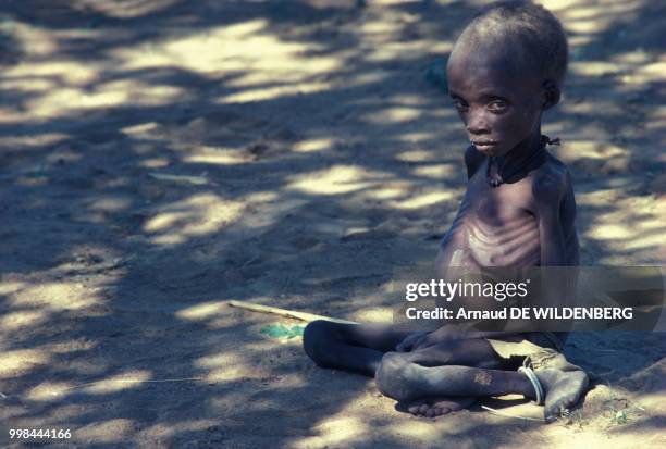 Enfant affamé en Ouganda en août 1980.