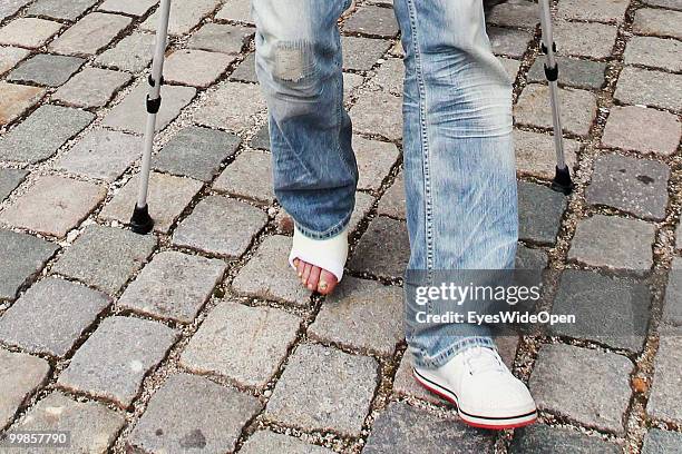 Michael Ballack, German National Football player, uses crutches leaving the practice of doctor Hans-Wilhelm Mueller-Wohlfahrt on May 17, 2010 in...